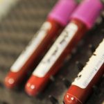 Gene Therapy Shows Promise for Blood Disorder Patients