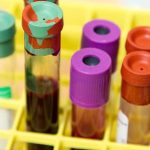 test tubes of blood samples representing facts about hemophilia