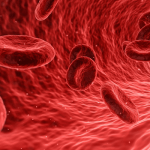 Thrombocytopenia