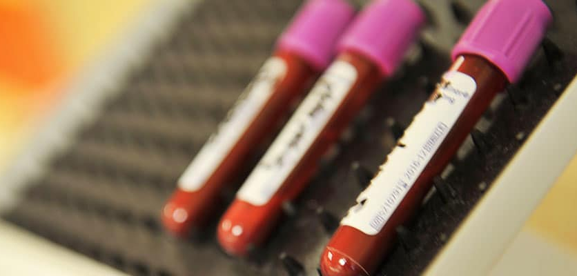 Gene Therapy Shows Promise for Blood Disorder Patients