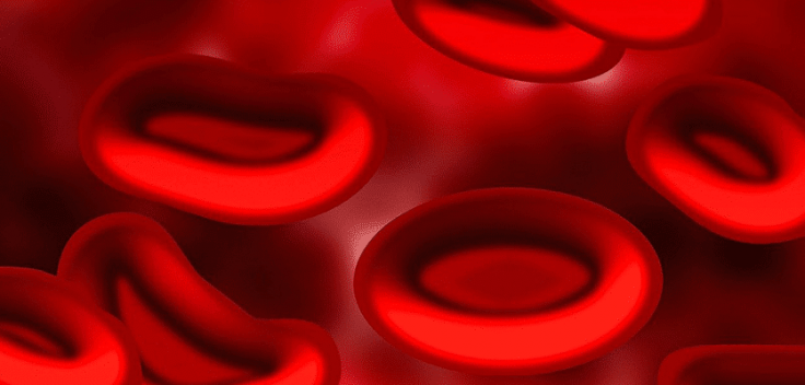 sickle cell anemia what you should know personalized hemonc